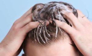 Men’s Hair Loss