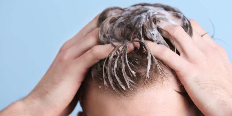 Men’s Hair Loss in Roswell, New Mexico